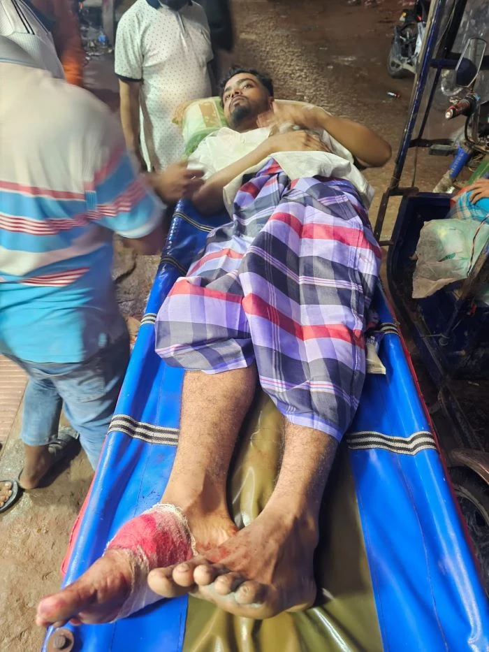 নোয়াখালীতে যুবদল কর্মির গুলিতে জামায়াতের ২কর্মী গুলিবিদ্ধ
